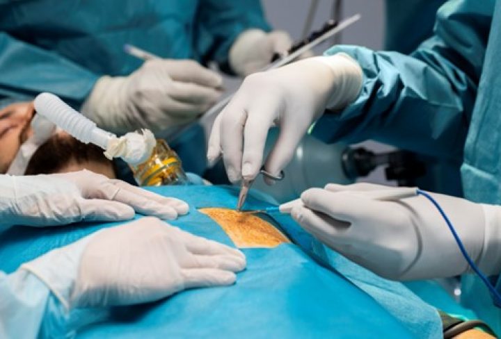 Laparoscopic Hernia Repair